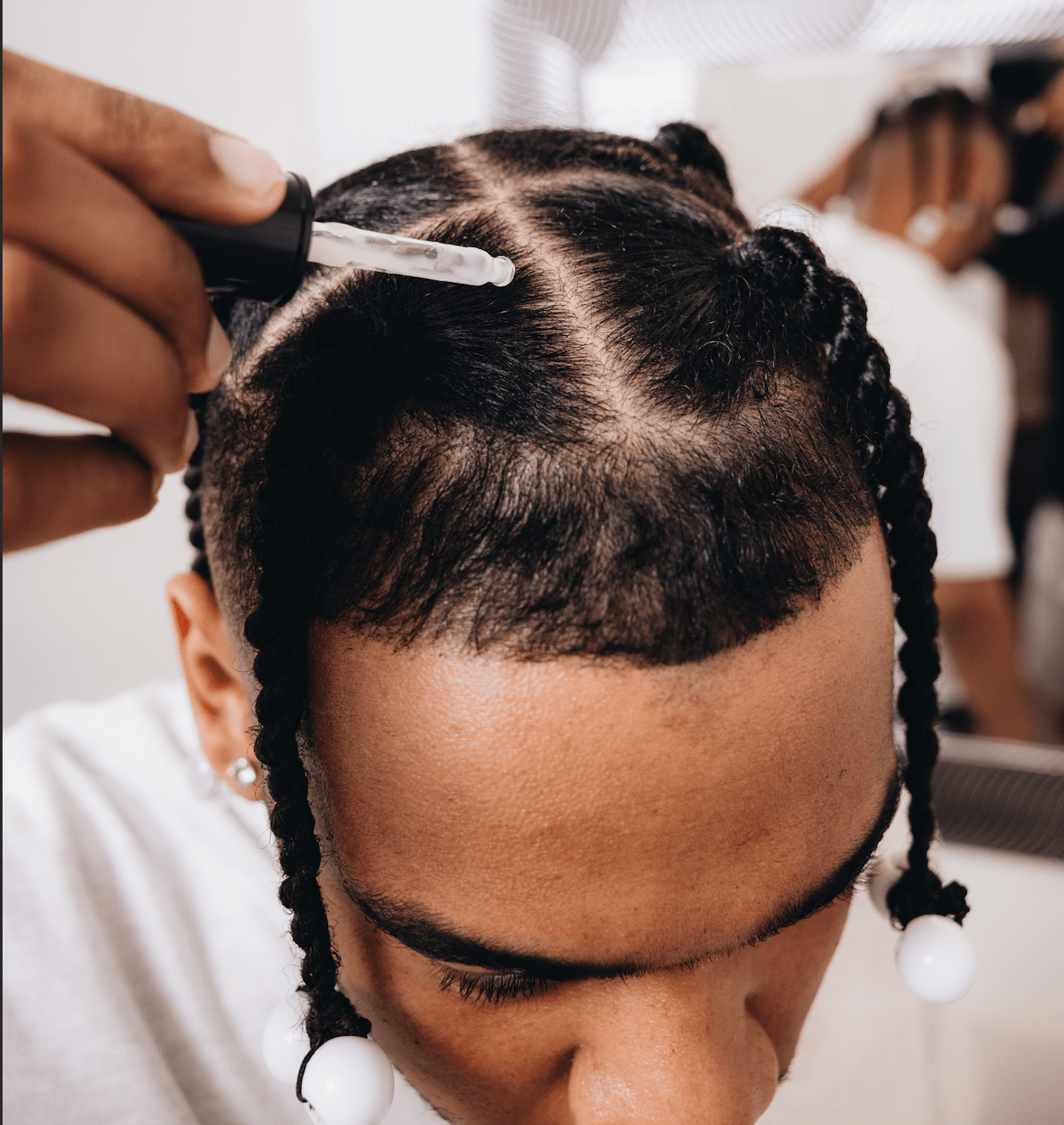 How to Prevent Dandruff When Wearing Braids: Simple Scalp Care Tips - REIN